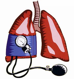 pulmonary hypertension